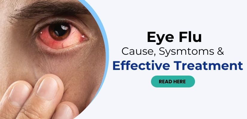 Eye Flu Causes, Symptoms
